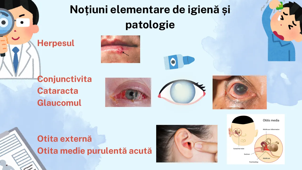Slide 40 din capitolul 3