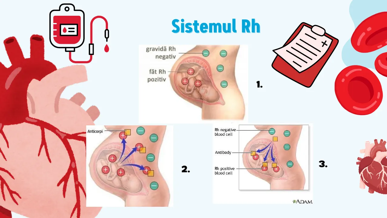 Slide 23 din capitolul 8
